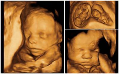 3D/4D ultrasound at Dr Mouhoub Dahbia's practice